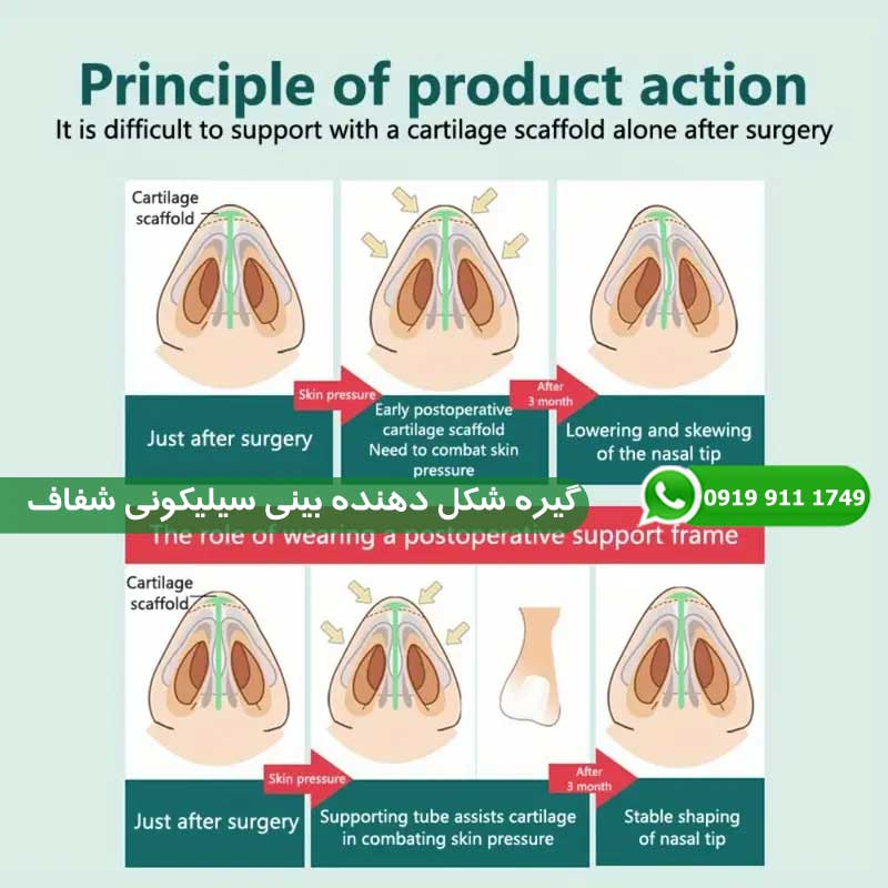 گیره شکل دهنده بینی سیلیکونی شفاف