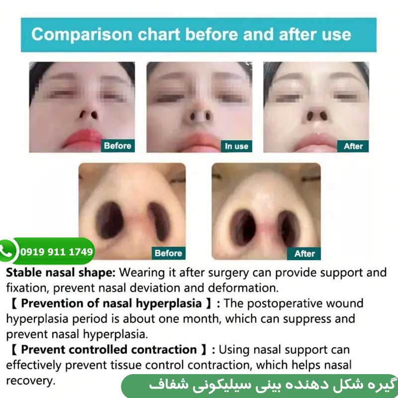 گیره شکل دهنده بینی سیلیکونی شفاف