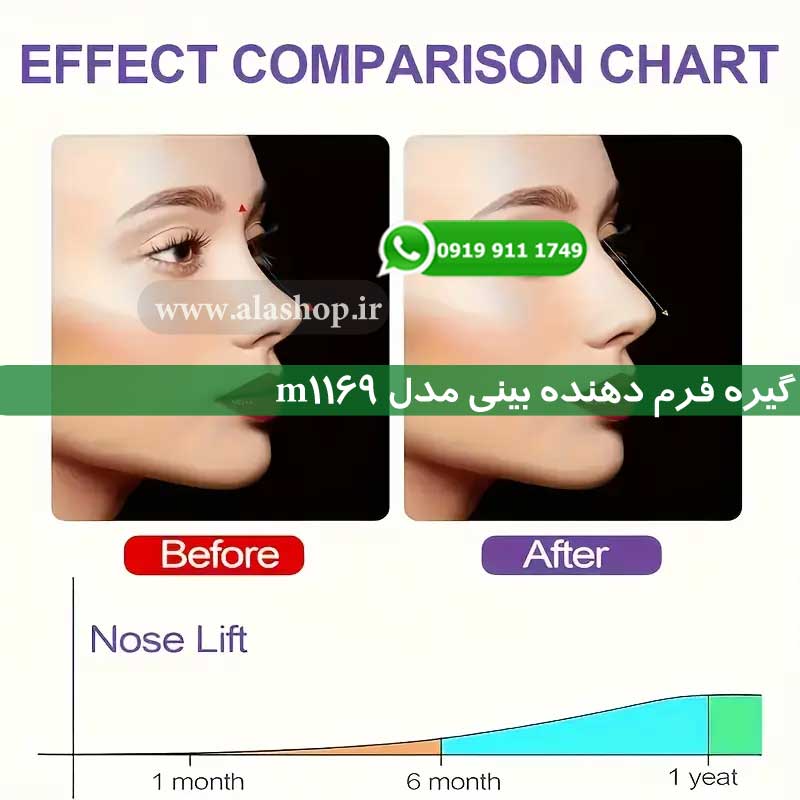 گیره فرم دهنده بینی مدل m1169